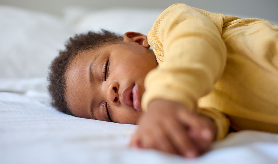 braquicefalia em bebes quando a cabeca achatada precisa de tratamento